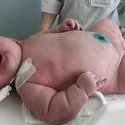 AUSTRALIA: 600-POUND WOMAN GIVES BIRTH TO 40-POUND BABY